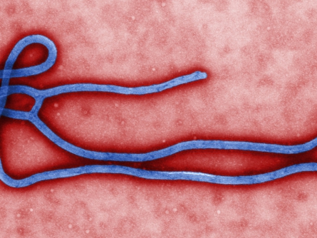 Ebolavirus, über dts Nachrichtenagentur