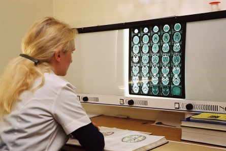 Giftiges Gadolinium aus MRT gelangt in die Nahrungskette